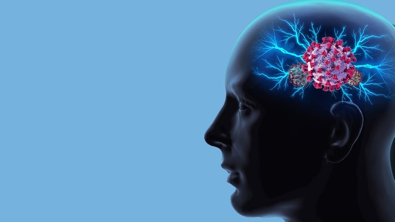COVID-19: las ideas de los expertos acerca de las secuelas en el cerebro y si puede causar daños duraderos