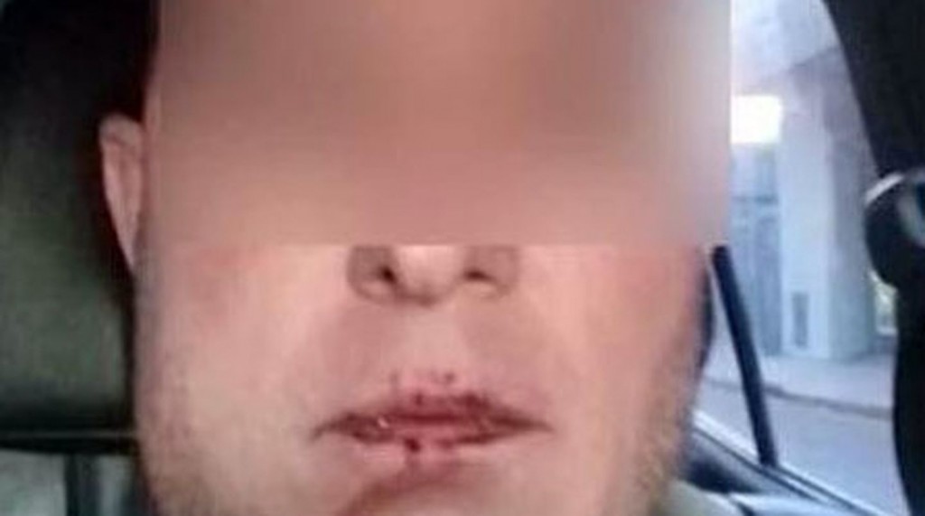 Cuatro policías le quebraron la mandíbula a golpes a un hombre tras detenerlo por error