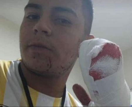 Tucuman: Brutal asalto con un machete a un repartidor de comida, perdió cuatro dedos