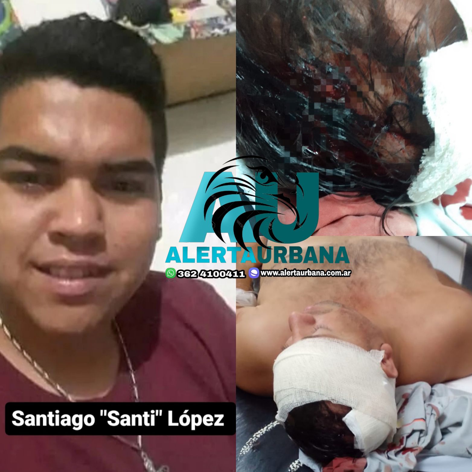“Santi” López aterroriza al B° El Timbó. Le partió la cabeza a un vecino a quien robó anteriormente