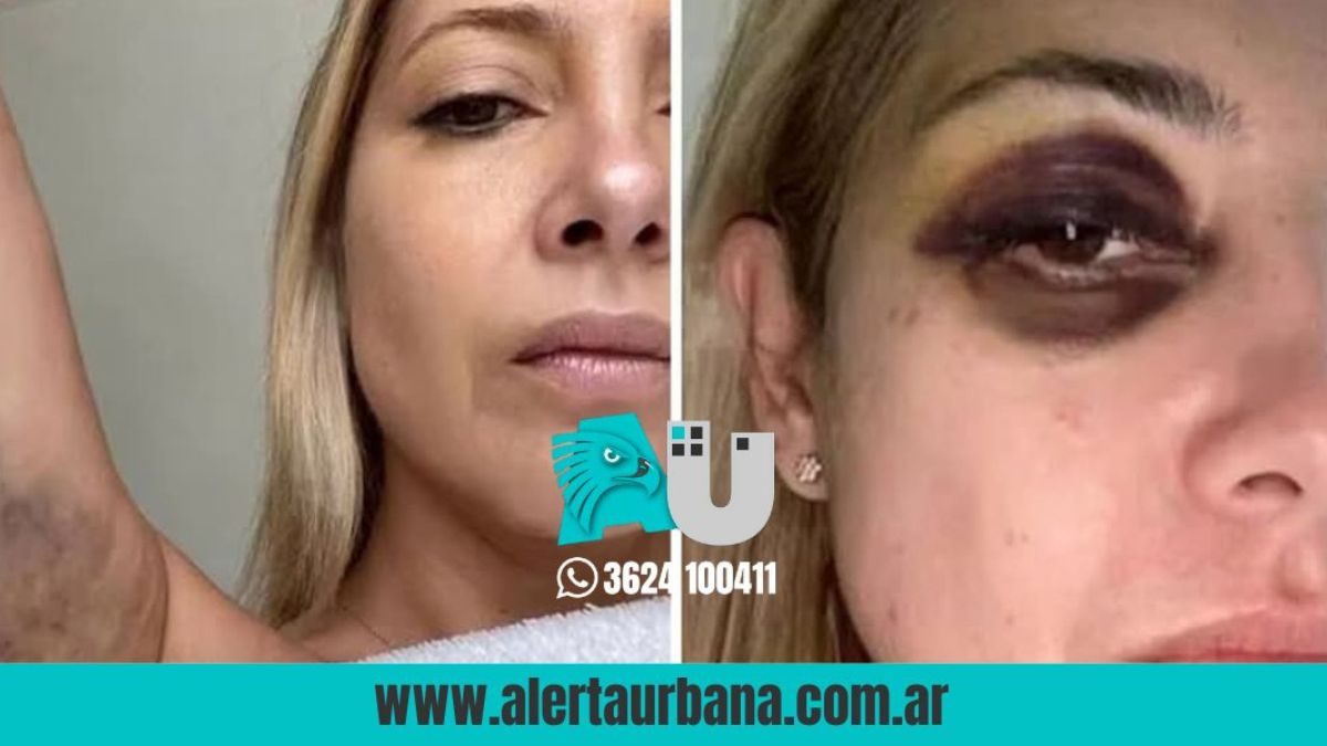 Ordenan pericia psicológica a Fabiola Yañez en medio de una disputa judicial con Alberto Fernández