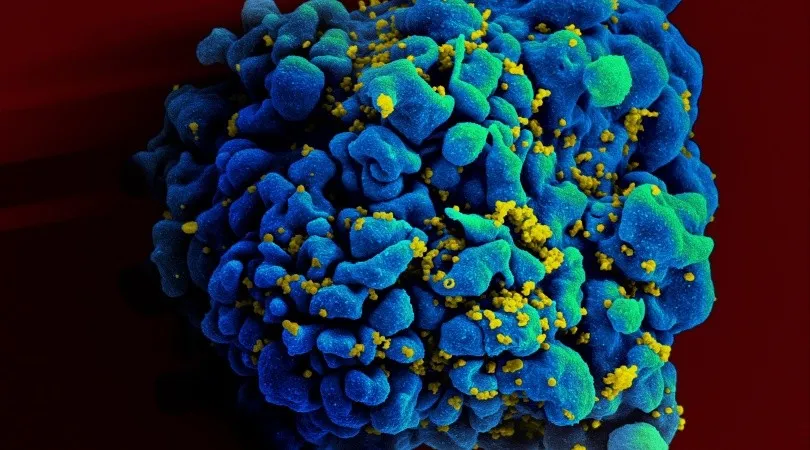 VIH: Un nuevo enfoque para encontrar caminos hacia la cura