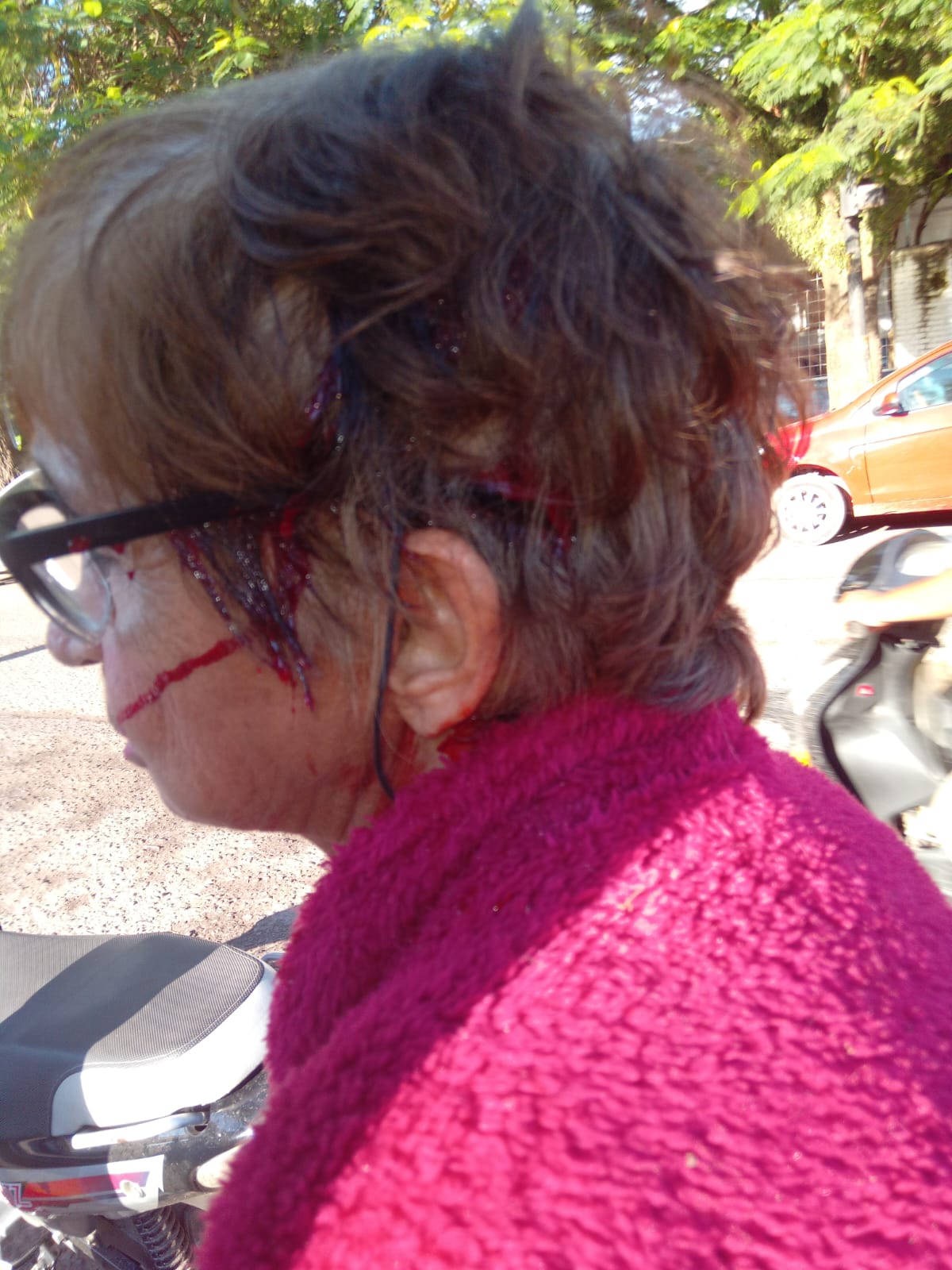 Resistencia: grave incidente en la avenida 9 de Julio: una mujer de 69 años terminó herida