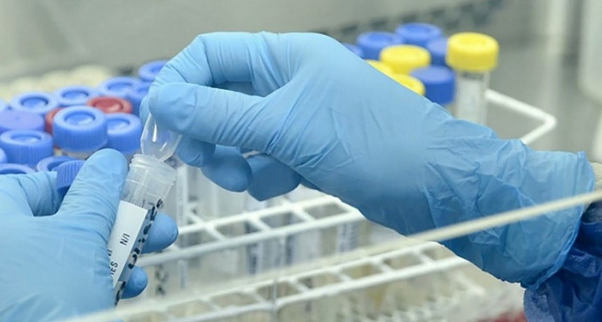 Salud publicó un plan de preparación y respuesta para el virus Mpox  