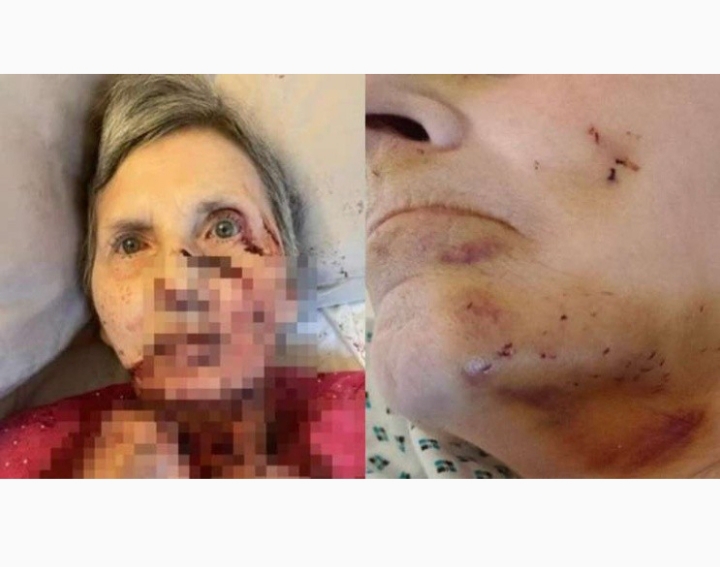 Una abuela fue atacada por una rata mientras dormía