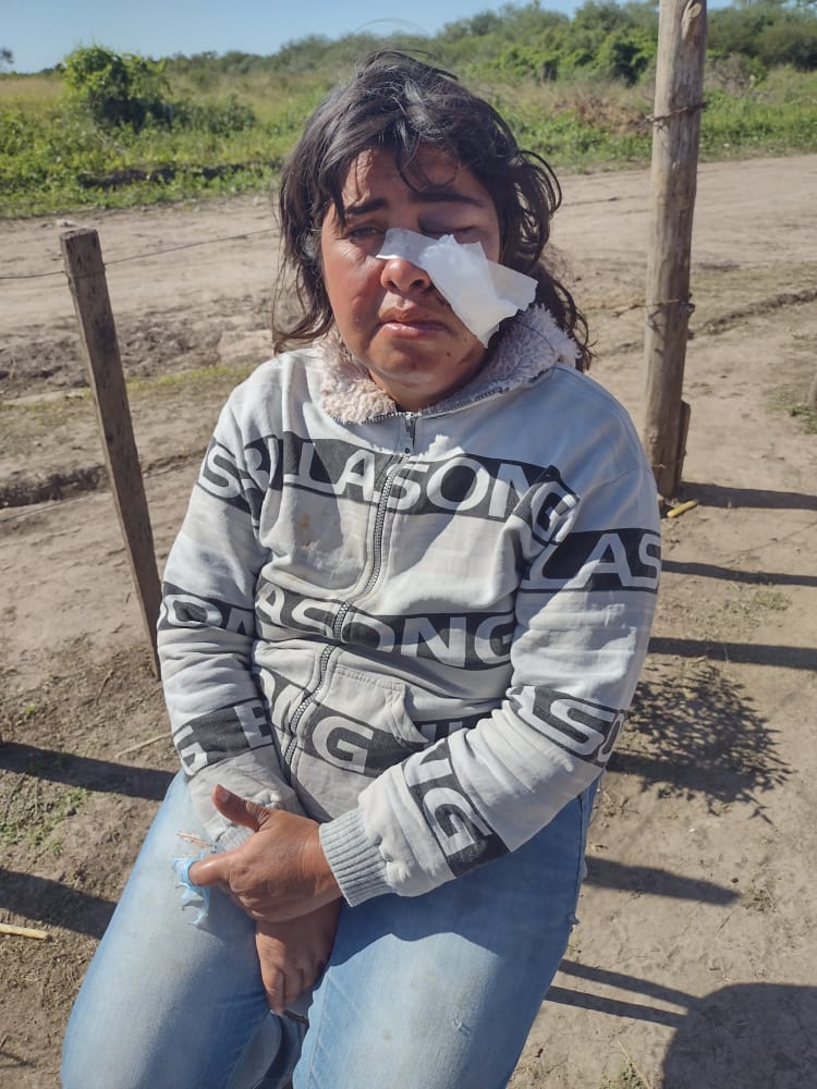 Sáenz Peña: Brutal agresión a una joven mamá. El atacante está  prófugo