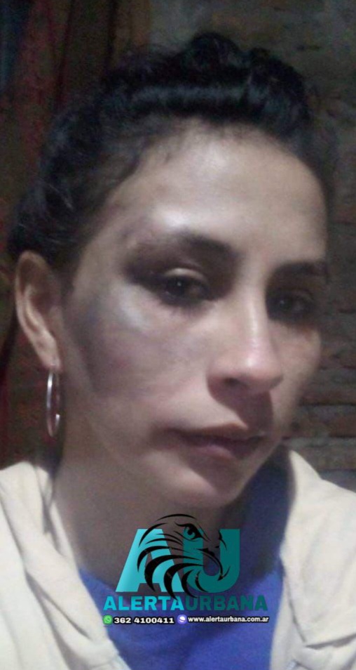 Barranqueras: su pareja la golpeó salvajemente y continúa libre
