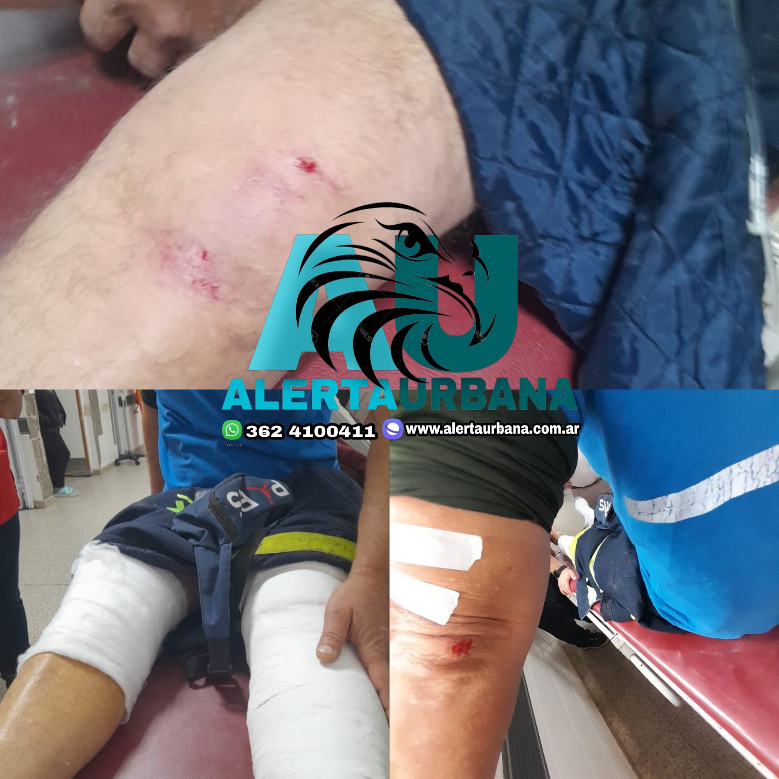 Sáenz Peña: chofer de ambulancia herido tras sufrir una golpiza