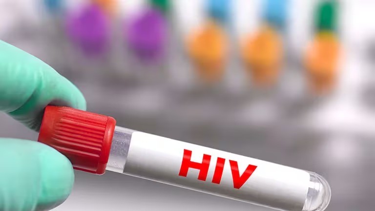 Un hombre fue condenado a 30 años de prisión por intento de transmisión del VIH a menores y adultos