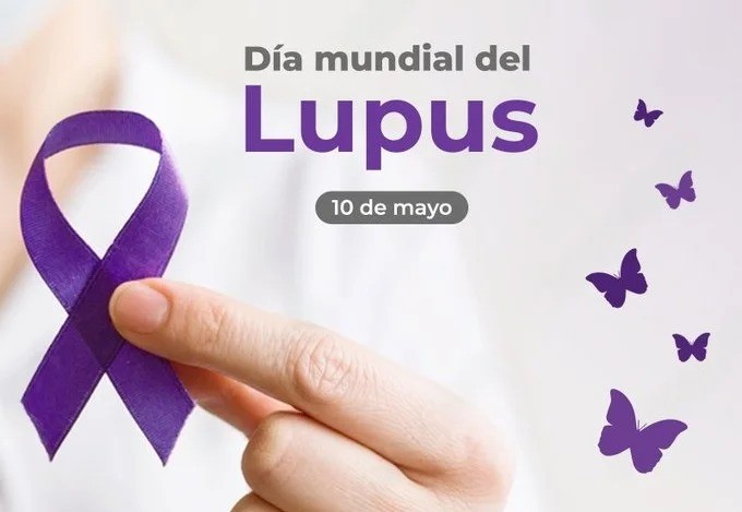 Efemérides. Día Mundial del Lupus: por qué se celebra cada 10 de mayo en Argentina