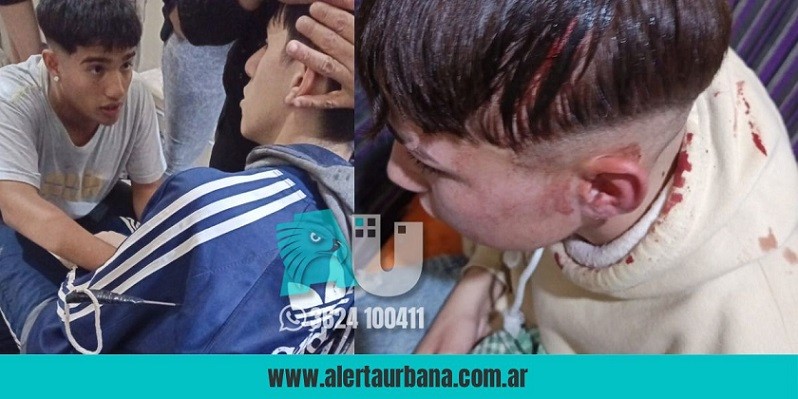 Un cumpleaños terminó con un herido con arma blanca incrustada en la cabeza