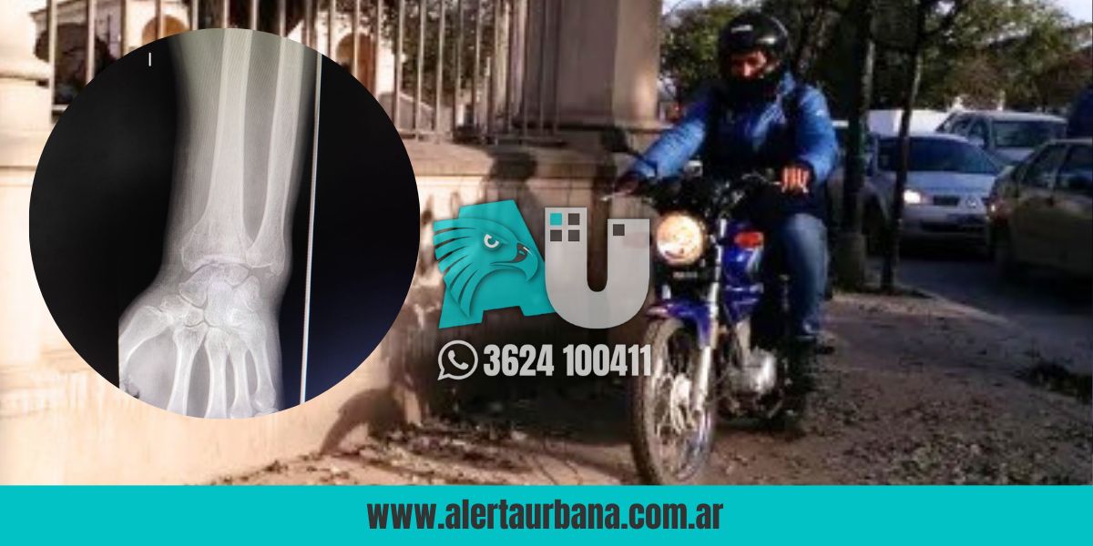 Esquivó un bache, anduvo en moto en la vereda y le pegaron hasta fracturarle las costillas