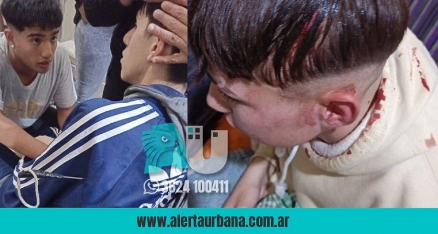 Un cumpleaños terminó con un herido con arma blanca incrustada en la cabeza