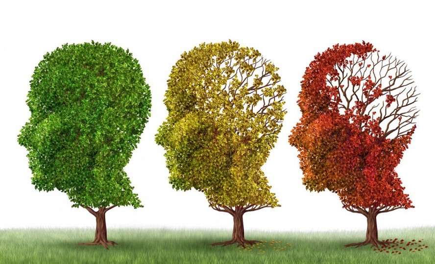 Tratamiento para el Alzheimer: para profesional de la UNNE es “modesta” aún la eficacia