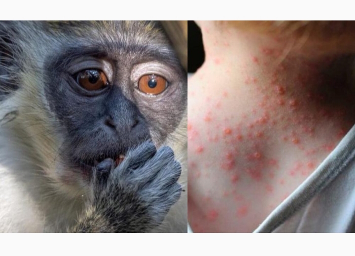 Reino Unido: quieren vacunar contra la viruela del mono a gays 