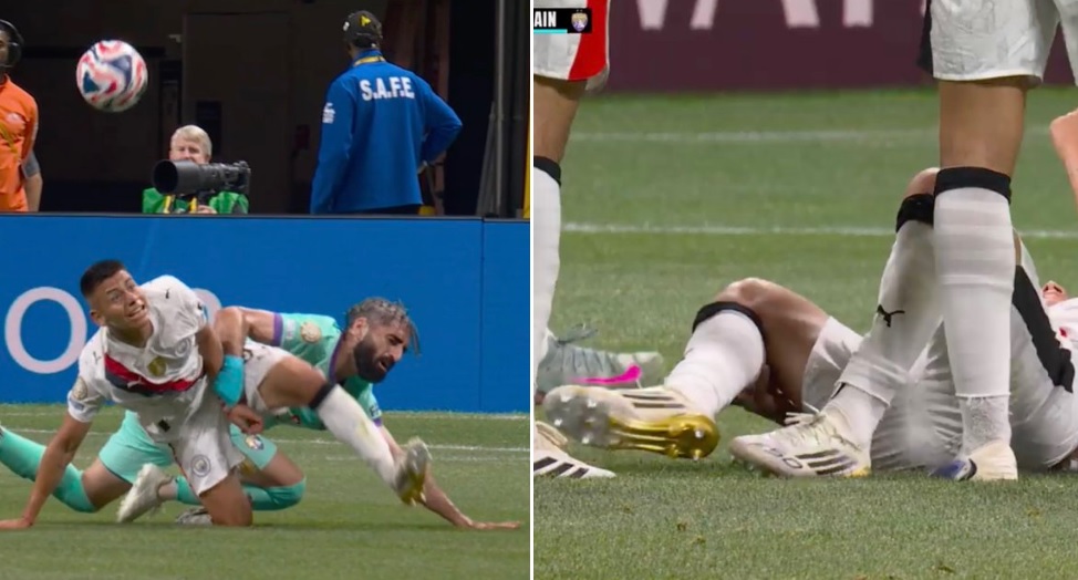 La escalofriante foto de la lesión del “Diablito” Echeverri en el partido del City
