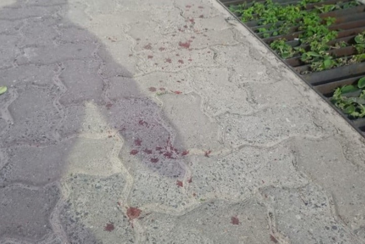 Salvaje agresión a un joven con un arma blanca en Villa María Selva: tendrán que amputarle la mano