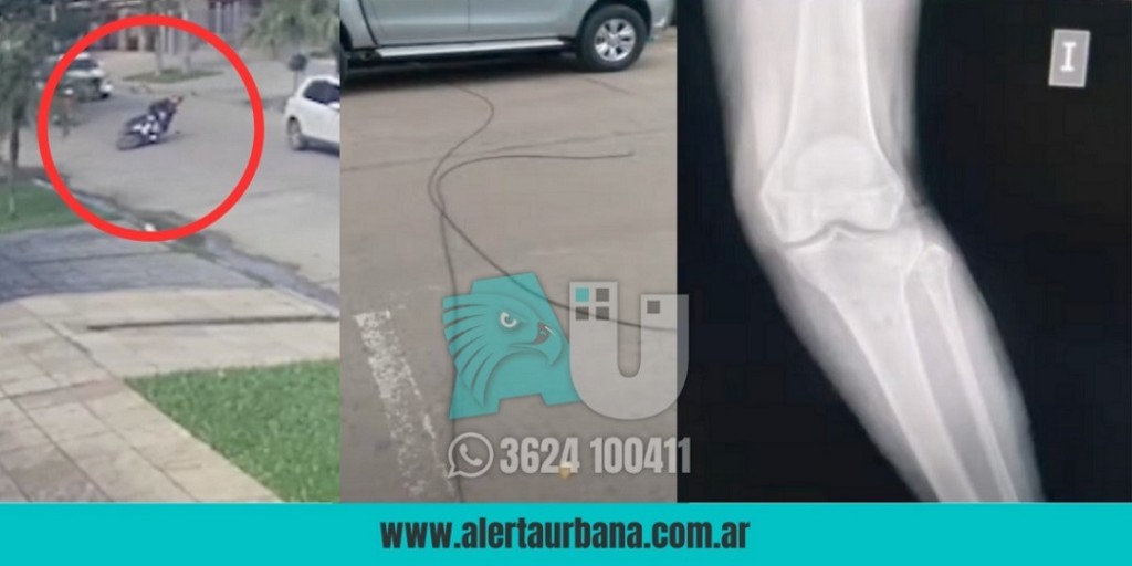 Accidente por cable caído: Buscan a testigos que auxiliaron a una mujer con fractura