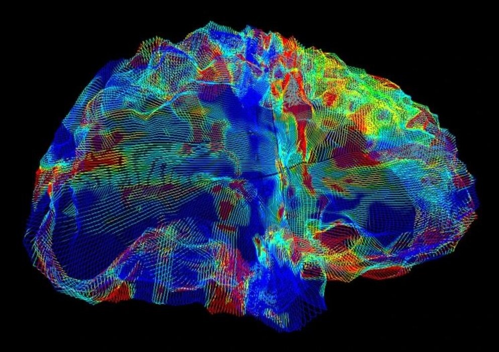 Afirman que un mismo gen podría aumentar el riesgo de Alzheimer, Parkinson y ELA