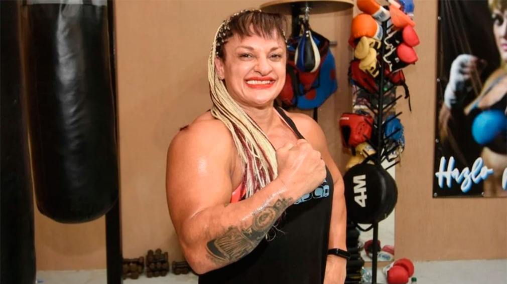 Preocupación por “Locomotora” Oliveras: “Las próximas 72 horas son clave” dijo el médico que la operó 