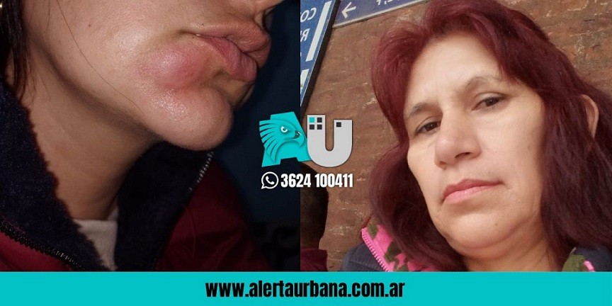 Resistencia: Denuncia que un policía la golpeó por cuestionar una violenta detención 