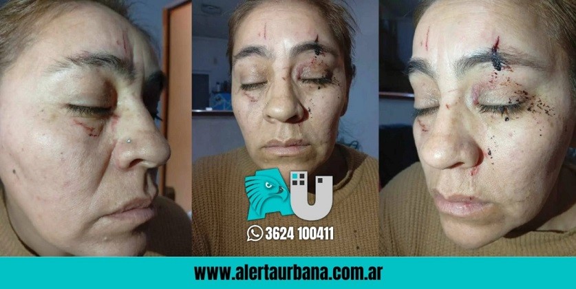 General Pinedo: Otra mujer denuncia haber sido golpeada por policías 
