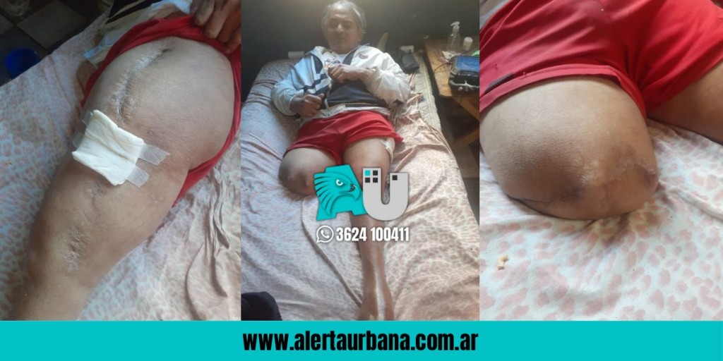 Pedido solidario: “No puedo caminar, tampoco quiero quedarme ciego”