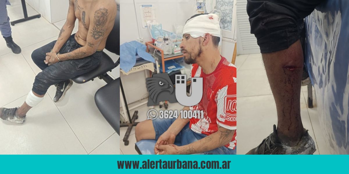 Zona Sur violenta: dos heridos, uno de ellos con pedido de captura, en un llamativo hecho