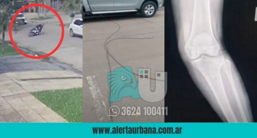 Accidentada por un cable: Cayó, se fracturó y ahora busca a testigos que la auxiliaron 