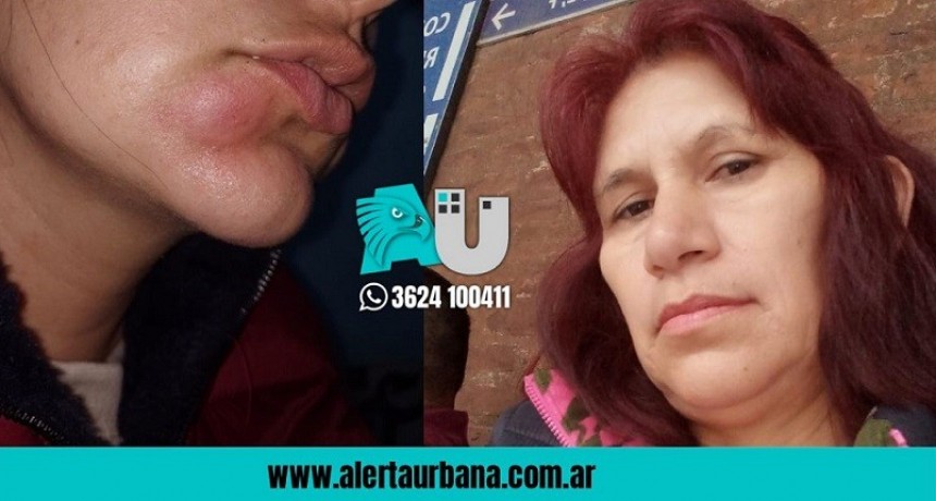 Resistencia: Denuncia que un policía la golpeó por cuestionar una violenta detención 