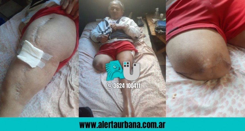 Pedido solidario: “No puedo caminar, tampoco quiero quedarme ciego”