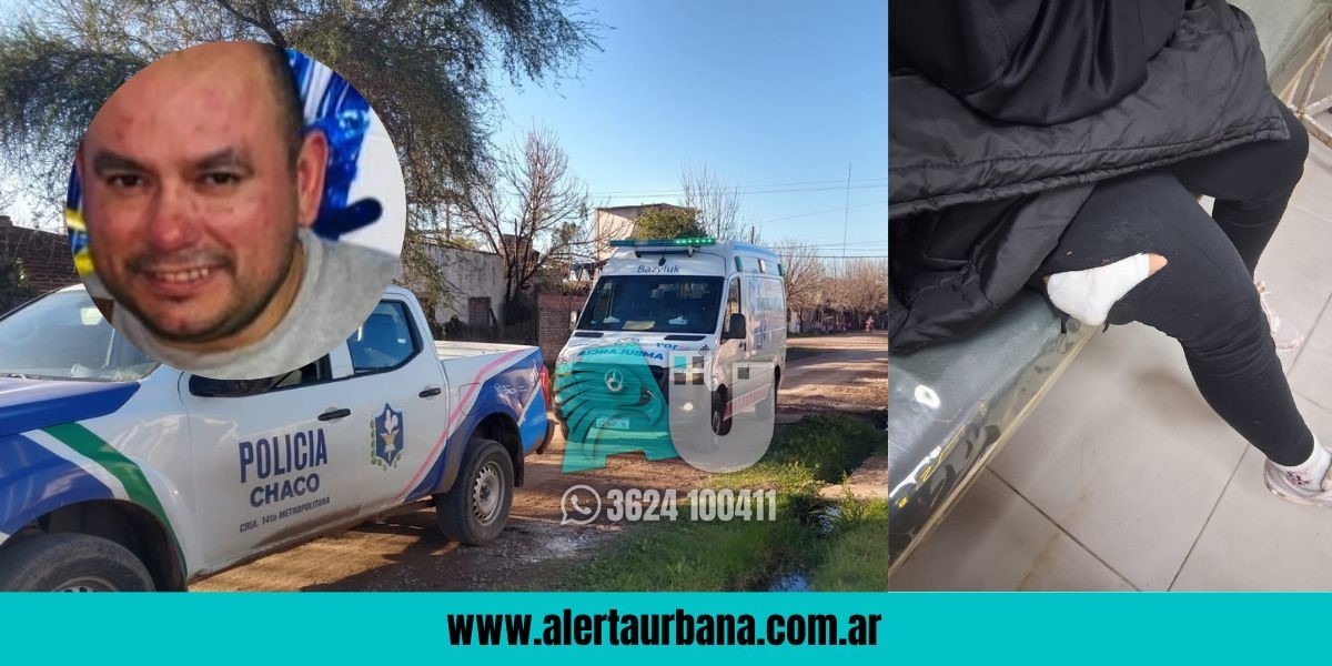 Intento de Femicidio en Resistencia: le disparó dos tiros a su ex, que debió ser hospitalizada