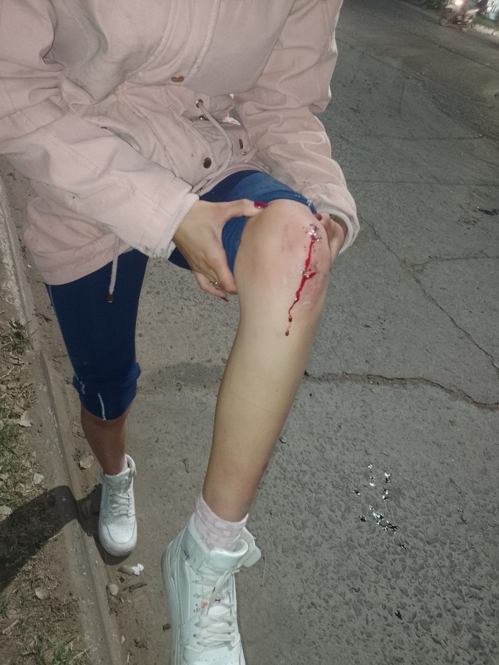 Derrame de una sustancia resbalosa convirtió a una calle en una pista de patinaje