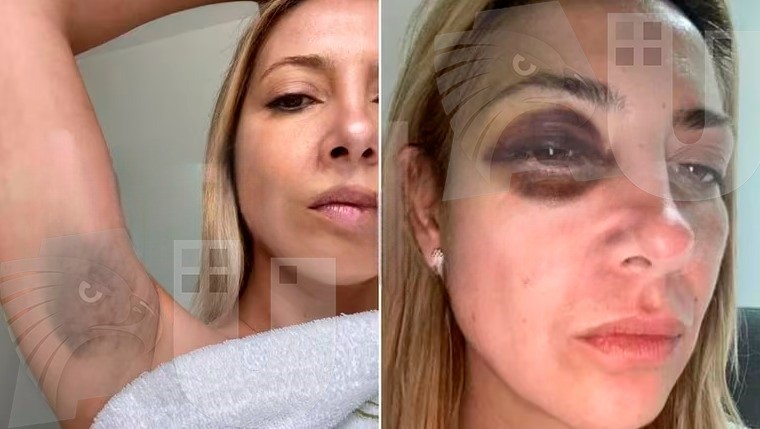 Las fotos de Fabiola que complican a Alberto Fernández: “Me venís pegando hace tres días seguidos”