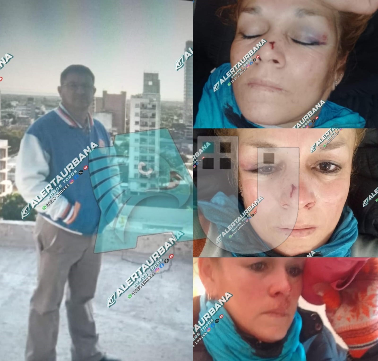 Violento desfiguró a su ex cuando se encontraba trabajando y vecinos intervinieron para que la soltara