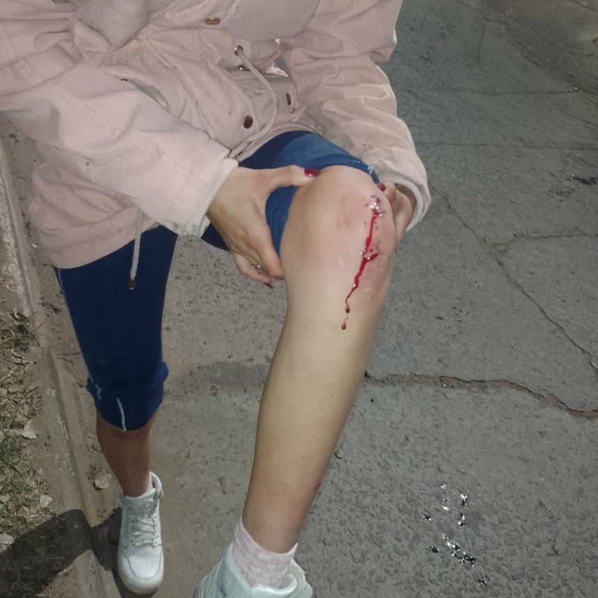 Derrame de una sustancia resbalosa convirtió a una calle en una pista de patinaje