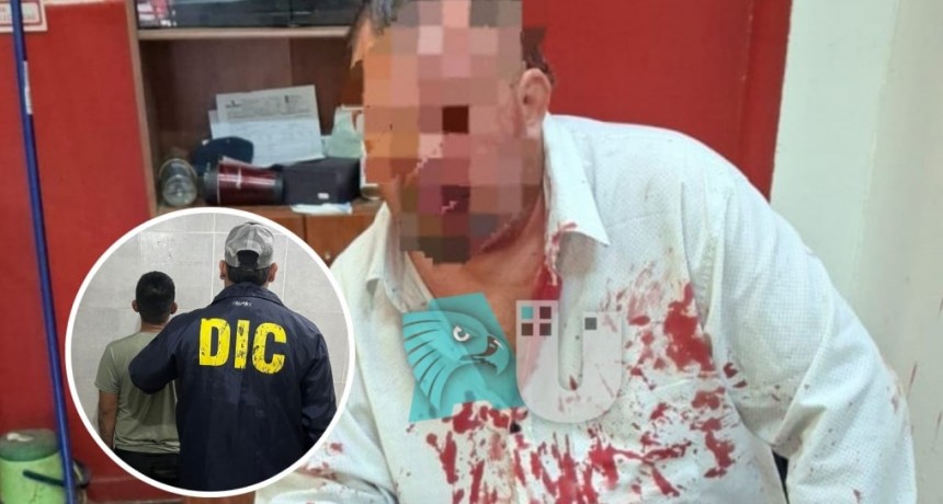 Detuvieron al que atacó a golpes a un comerciante céntrico para robarle 