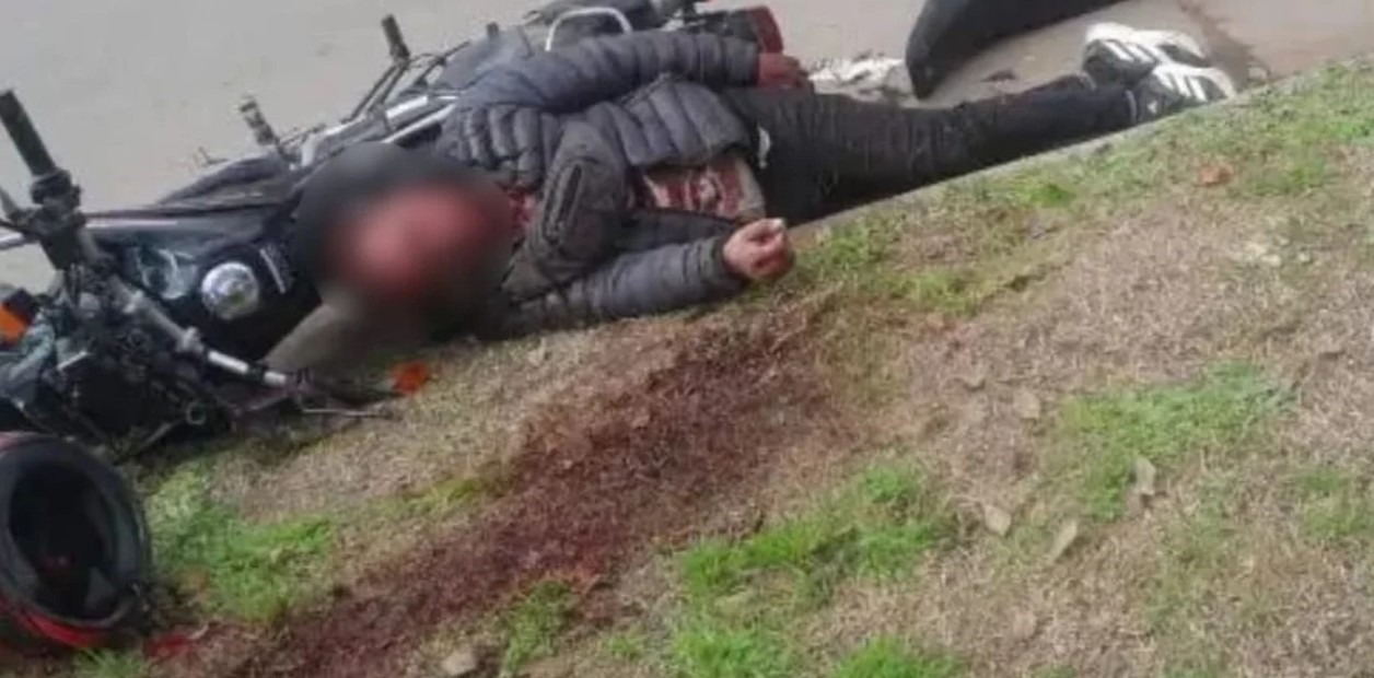 Custodio de Milei baleó en la cabeza a un motochorro y frustró robo