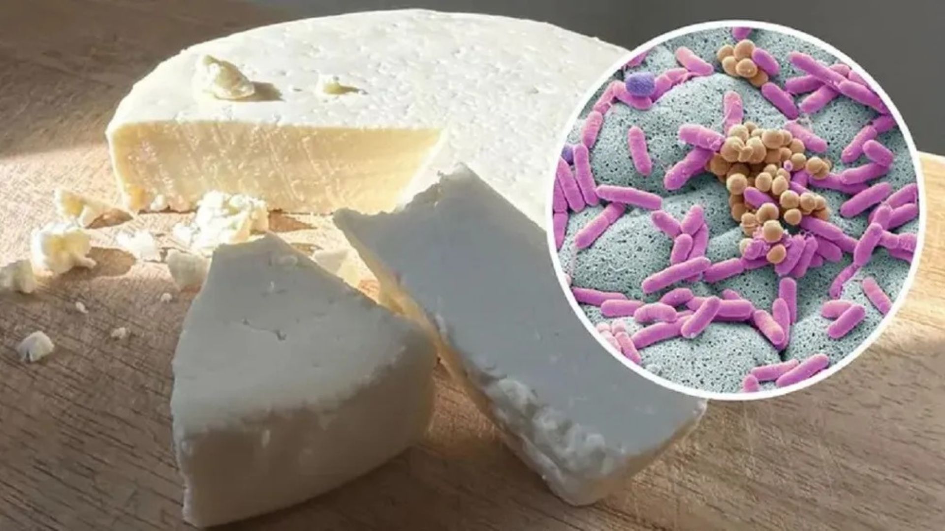 Confirman un brote de listeriosis por consumo de queso: de qué se trata