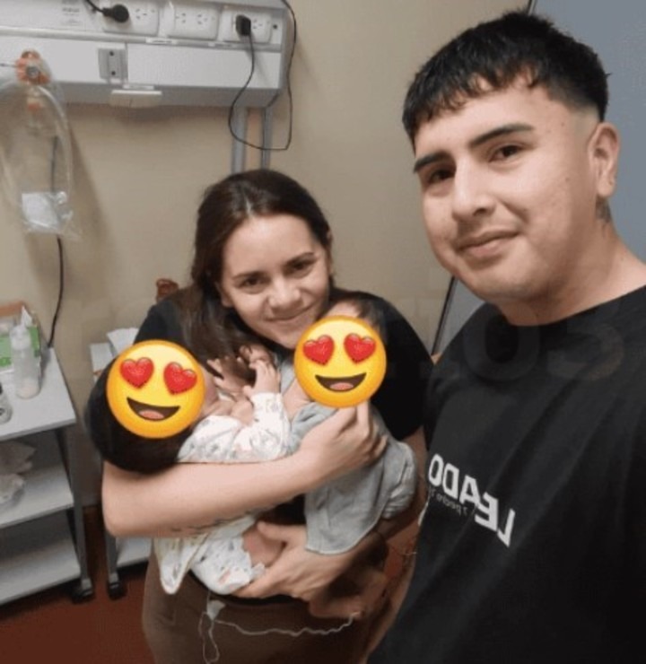 Milagro en el Garrahan: separaron con éxito a dos siamesas unidas por el abdomen y el hígado 