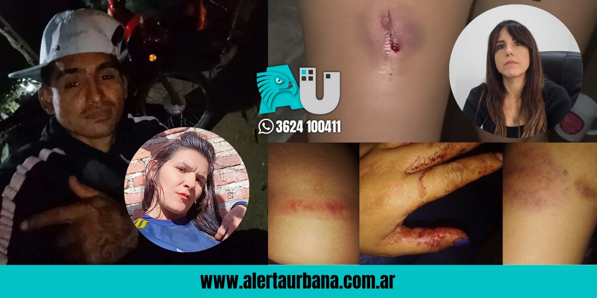 Detuvieron al violento que cortó la tobillera y atacó a chicotazos a su ex en Villa Libertad