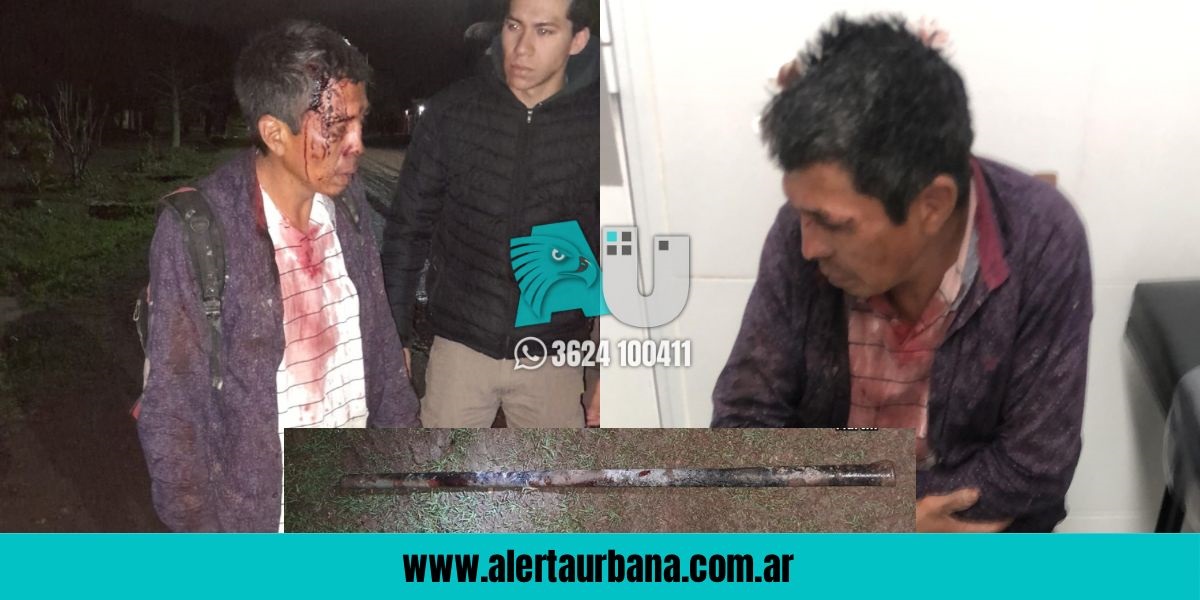 San Martín: una discusión por un cigarrillo termina con un joven muerto a puñaladas