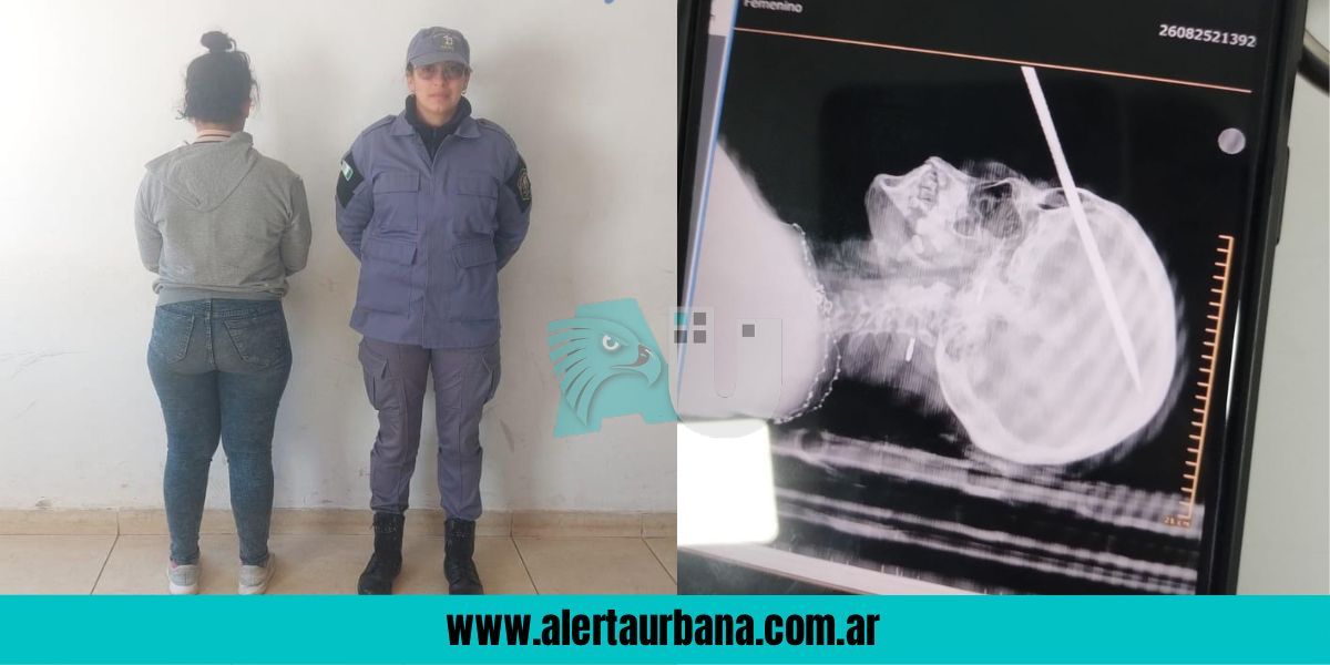 San Martín: violenta disputa familiar termina con una mujer y un hierro clavado en la cabeza
