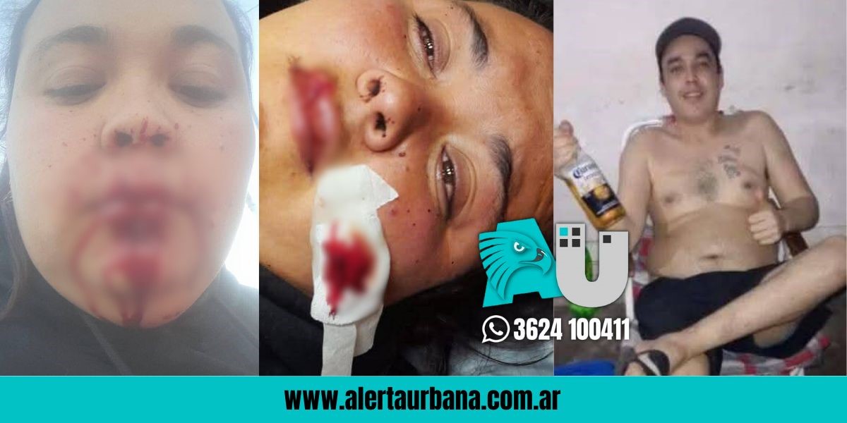 Una mujer quiere que su hermano siga preso: la atacó con un destornillador y amenazó con quemar la casa de su abuelo