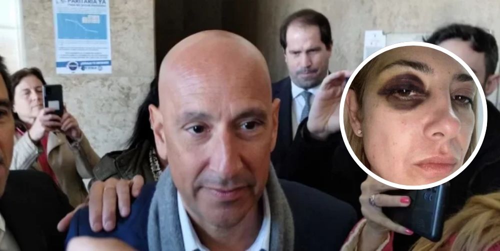  El exmédico presidencial confirmó que atendió un moretón de Fabiola que le dijeron que fue “involuntario”
