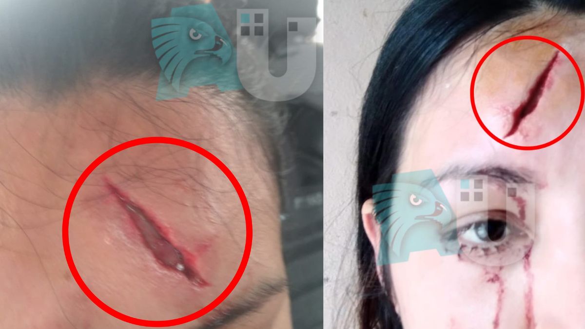  Lo denunció por ladrón y la agredió brutalmente: la mujer teme por su vida