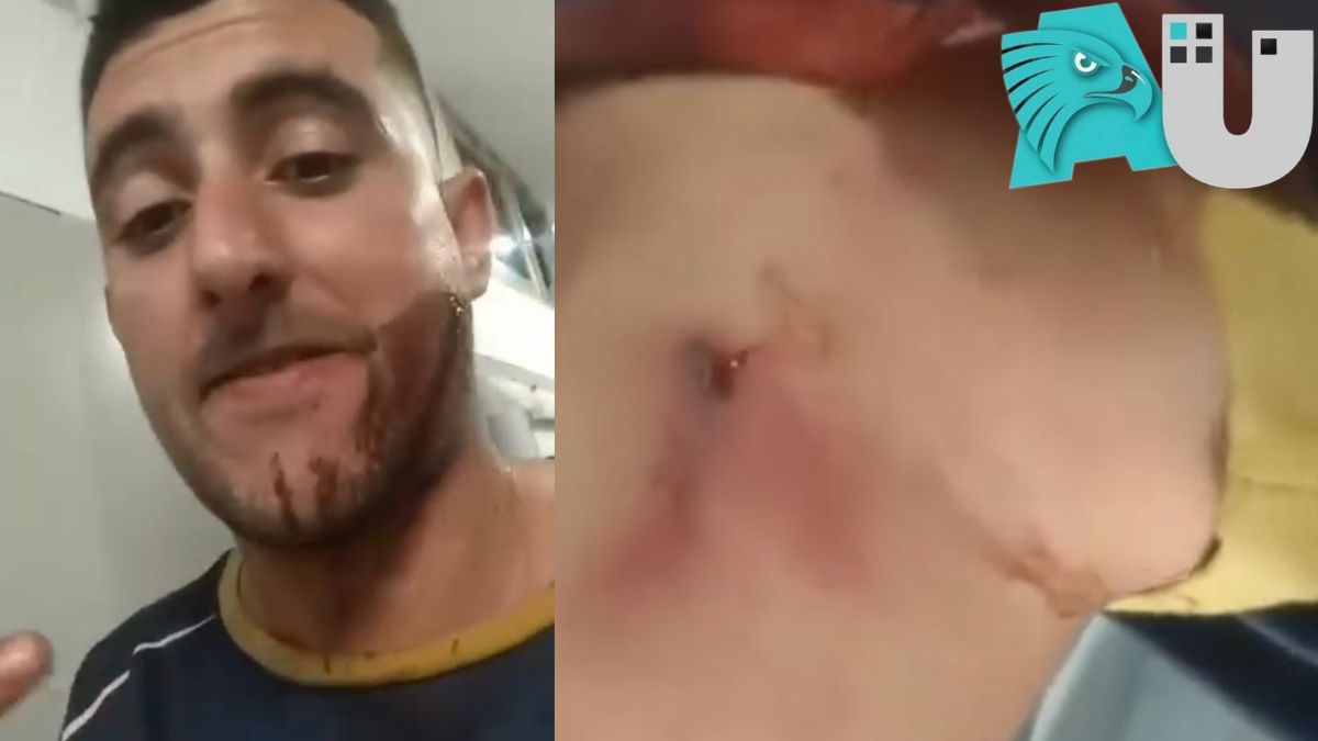 Resistencia: ajustes entre barras, le dispararon en el rostro y está vivo de milagro 
