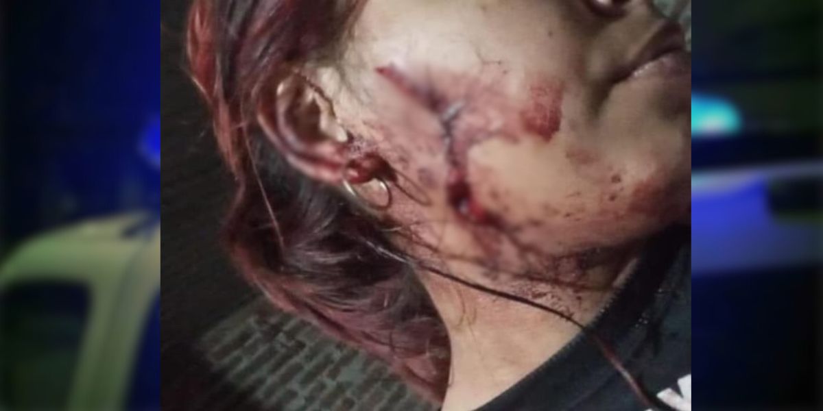 Violento ataque en Plaza: agredió a su expareja con una botella rota y se fugó