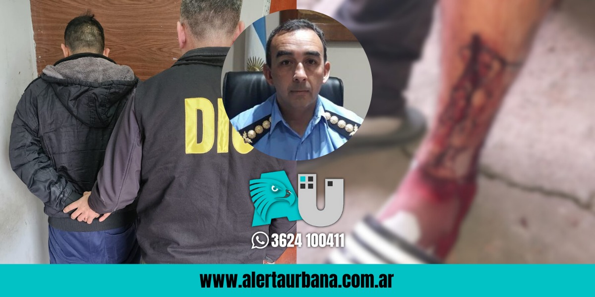 Caso “Bola Ocho”: “La persona lesionada no quiere hablar”, aseguró Romero