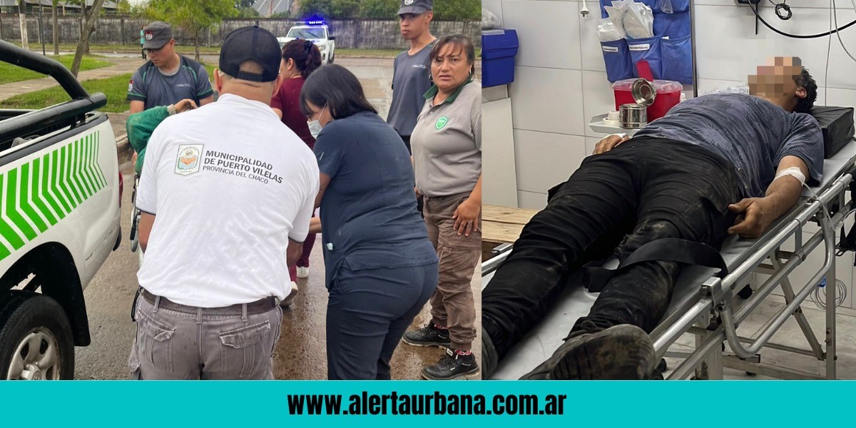 Vilelas: lo impactó un rayo y salva su vida de milagro